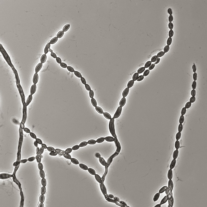 Microscope image of Cladophialophora bantiana grown in a lab slide culture: thin branching threads with long chains of small oval spores, seen in phase contrast.